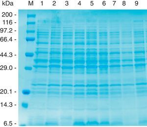 Whole-cell protein patterns of A. pleuropneumoniae strains of serovars 8 and 15 on 12.5% polyacrylamide gel stained with CBB. Lanes: 1, HS143 (serovar 15); 2, NBAP008 (serovar 15); 3, CCM 3803 (serovar 8); 4, FN01 (serovar 15); 5, NBAP009 (serovar 8): 6, ARG65 (serovar 8); 7, ARG43 (serovar 8); 8, ARG45 (serovar 8); and 9, 405 (serovar 8). M, molecular weight marker in kilodaltons (kDa).