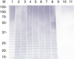 Immunoblot analysis of the purified LPS of A. pleuropneumoniae strains of serovars 8 and 15 probed with sera derived from pigs experimentally infected with reference strain HS143 of serovar 15. Lanes: 1, HS143 (serovar 15); 2, 405 (serovar 8); 3, NBAP008 (serovar 15); 4, FN01 (serovar 15); 5, NBAP009 (serovar 8): 6, ARG65 (serovar 8); 7, ARG43 (serovar 8); 8, ARG45 (serovar 8); 9, 4074 (serovar 1); 10, CCM5870 (serovar 2); and 11, K17 (serovar 5a). M, molecular weight marker in kilodaltons.