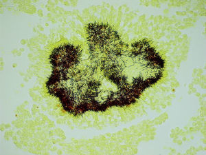 Se observa grano de azufre con bacterias formando una empalizada en una biopsia pleural. Tinción de Gram 400×.