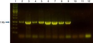 Gel de agarosa al 1% en solución amortiguadora TAE, mostrando los productos de PCR de 1kb generados con los iniciadores ligBFpet y ligBRpet en las especies patógenas de Leptospira spp. y la ausencia de amplificación en las especies no patógenas de Leptospira spp. Calle 1: marcador de ADN 1 kpb (INBIO Highway, Argentina); calle 2: L. interrogans serovar Pomona cepa Pomona; calle 3: L. interrogans serovar Canicola cepa Hond Utrecht IV; calle 4: L. borgpetersenii serovar Castellonis cepa Castellon 3; calle 5: L. interrogans serovar Wolffi cepa 3705; calle 6: L. interrogans serovar Pyrogenes cepa Salinem; calle 7: L. interrogans serovar Hardjo cepa Hardjoprajitmo; calle 8: L. interrogans serovar Copenhageni cepa M 20; calle 9: L. interrogans serovar Canicola cepa Hond Utrecht IV aislada de una comadreja; calle 10: L. biflexa serovar Patoc cepa Patoc I; calle 11: L. biflexa serovar Andamana cepa Andamana; calle 12: control de contaminación sin templado.