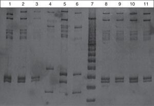 Perfil MLVA de aislamientos SARM-AC estudiados (n=21). Electroforesis en gel de poliacrilamida con tinción de nitrato de plata de algunos (n=10) de los productos obtenidos por la técnica MLVA. Carril: 1) SGP14; 2) SGP17; 3) SGP11, el cual no pudo ser tipificado (se observa amplificación parcial de los locus estudiados); 4) SGP21; 5) SGP22; 6) SGP29; 7) marcador de PM de 50 pb Fermentas (GeneRuler 50 bp DNA Ladder, Fermentas [ThermoFisher], Waltham, Massachusetts, EE. UU.); 8) SGP32; 9) SGP34; 10) SGP57 y 11) SGP58.