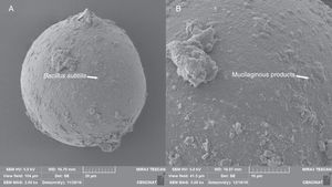 Scanning electron micrographs of surface of A. colombiana spores. (A) B. subtilis adhering to the surface of the laminated layer of the spore surface after 15 days of inoculation. (B) Mucilaginous outer hyaline layer starting to “peel off” and being replaced by mucilaginous products (arrow).