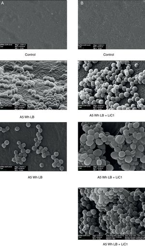 Scanning electron micrographs of biofilm formation by Rhodococcus sp. A5wh on expanded polystyrene using LB medium (column A) and LB+LiCl 1M (column B).