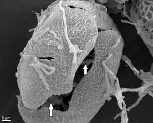 SEM observation of T. canis eggs + C. keratinophylum incubated for 14 days. Alterations in the shell structure (black arrow), presence of mycelia inside the egg and egg rupture (white arrow) (1400×). Type 3 effect.