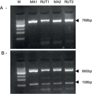 Helicobacter pylori clarithromicyn resistance analysis by PCR-RFLP. DNA was purified from biopsies for the rapid urease test (RUT) and for molecular analysis (MA). Amplicons (768bp) from wild type strains were digested with MboII (A) and BsaI (B). M, molecular size marker (Cien Marker, Biodynamics, Buenos Aires, Argentina).