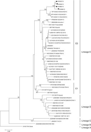 Phylogenetic tree of the complete VP1 gene of Argentinean Coxsackievirus A6 strains from atypical hand, foot and mouth disease, 2015. For lineage classification, other selected strains from GenBank were included (accession numbers are given in the phylogenetic tree). The maximun likehood method was used to construct the tree using MEGA version 6.0 (https://www.megasoftware.net). The phylogenetic tree was determined for 1000 replicates with random seeds. Only strong bootstrap values (>70%) were shown; (black dot) indicates Argentinean strains (GenBank accession No. KX575862-65).
