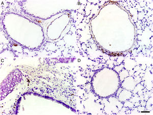Immunohistochemical detection of IgA. Diaminobenzidine chromogen and hematoxylin counterstaining. (A–C) Positive immunostaining in peribronchiolar, perivascular and peribronchial tissue, respectively. (D) Negative IgA detection in the lungs of non-immunized and challenged mice.