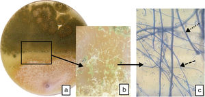 Interacción de hifas entre A. flavus y F. verticillioides. a) Se observa la interacción por contacto de ambos micelios en placa de Petri de 90 mm; b) mayor detalle en microscopio estereoscópico (×80): se advierte la interacción por contacto de las hifas y la presencia de estructuras de reproducción asexual entre ambos micelios; c) interacción de las hifas y estructuras reproductivas asexuales teñidas con azul de metileno (microscopio óptico, ×400): flecha discontinua de puntos: A. flavus; flecha discontinua de guiones: F. verticillioides.