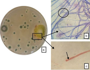 Interacción entre A. flavus y T. funiculosus. a) Contacto entre colonias en placa de Petri de 90 mm: se observa en la zona de contacto una coloración intensa (en cuadro negro) producida por un extrolito de T. funiculosus; b) contacto de hifas (teñidas con azul de metileno) entre ambos micelios (×1000); c) hifa de T. funiculosus (indicada por la flecha) parasitando una hifa de A. flavus (×1000).