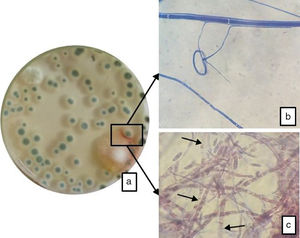 Interacción entre F. verticillioides y T. funiculosus. a) Contacto entre colonias en placa de Petri de 90 mm: en cuadro negro se observa en la zona de contacto una banda producida por un extrolito de T. funiculosus; b) contacto entre hifas de ambas especies (teñidas con azul de metileno), hifa de mayor grosor con detalle de tabiques: F. verticillioides (×1000); c) hifas y conidios de F. verticillioides: las flechas indican zonas de lisis celular, confirmando evento de parasitismo de T. funiculosus (×400).