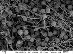 Hifas largas y ramificadas de H. capsulatum con microconidios y macroconidios. Imagen de MEB (×1.500, Bar=10μm).