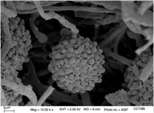 Macroconidio tuberculado de H. capsulatum. Imagen de MEB (×10.000, Bar=2μm).