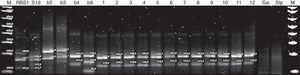 Multiple PCR-MLVA-2 for RB51 (Vaccine strain RB51, biovar 1), S19 (vaccine strain S19, biovar 1), b2 (reference strain B. abortus, biovar 2), b3 (reference strain B. abortus, biovar 3), b4 (reference strain B. abortus, biovar 4), b9 (reference strain B. abortus, biovar 9), 1–12 isolates of B. abortus, Sal: Salmonella enteritidis and Stp: Staphylococcus aureus; M: DNA marker 100bp Invitrogen®.
