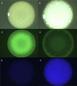 Colony biofilms of A. tumefaciens 6N2 and M. guilliermondii 6N growing on YPD agar. A, C and E: pure colony of 6N2 observed with visible illumination, GFP filter and DAPI filter, respectively. B, D and F: colony of mixed cultures of 6N2 and 6N observed with visible illumination, GFP filter and DAPI filter, respectively.