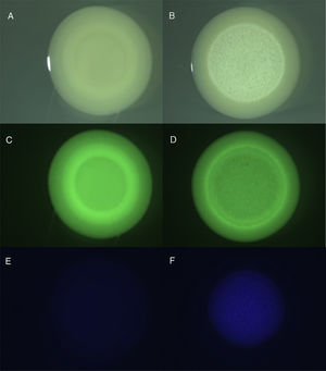 Colony biofilms of A. tumefaciens 6N2 and M. guilliermondii 6N growing on NA. A, C and E: pure colony of 6N2 observed with visible illumination, GFP filter and DAPI filter, respectively. B, D and F: colony of mixed cultures of 6N2 and 6N observed with visible illumination, GFP filter and DAPI filter, respectively.