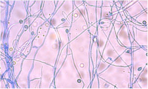 Micromorfología de Scedosporium sp. por la técnica de cultivo de adhesión, coloreada con azul de lactofenol ×400.