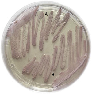 Appearance of yeast colonies on CHROMAgar Candida (CHROMagar Company, France) isolated from the blood culture (A) and capsule contents (B).