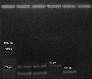Productos de PCR para la identificación de las cepas estudiadas. Calle 1 Marcador molecular, calle 2 E. hirae 463Me, calle 3 E. hirae 471Me, calle 4 E. faecalis ATCC 29212, calle 5 E. hirae F6, calle 6 control negativo.