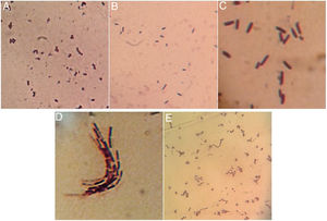 Microscopy morphology of lactic acid bacteria isolated from tepache. (A) Strain AB-1, (B) strain AB-2, (C) strain AB-3, (D) strain AB-4 and (E) strain AB-5.