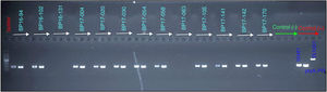 Amplification of IS481, ptxA-Pr and IS1001 of Bordetella pertussis. PCR products were analyzed in a 2% agarose gel by electrophoresis.