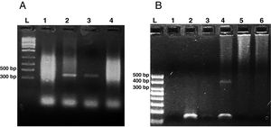Agarose gel electrophoresis (2%) showing amplification products from the nested from ethanol-fixed stool samples. (A) PCR from Enterocytozoon bieneusi positive stool sample. L: molecular weight ladder. Lanes 1–3: products of nested PCR (with inner primers ITS1 and ITS2) using diluted products from PCR as DNA template (Lane 1: 1/10, Lane 2: 1/100, Lane 3: 1/1000). Lane 4: PCR product using undiluted DNA template from PCR. (B) Nested PCR from different stool samples. L: molecular weight ladder, Lane 1: negative control (H2O), Lane 2: negative stool sample A (PCR product diluted 1/100), Lane 3: negative stool sample B (1/100), Lane 4: positive stool sample (1/100), Lane 5: negative stool sample A (diluted 1/10), negative stool sample B (diluted 1/10).