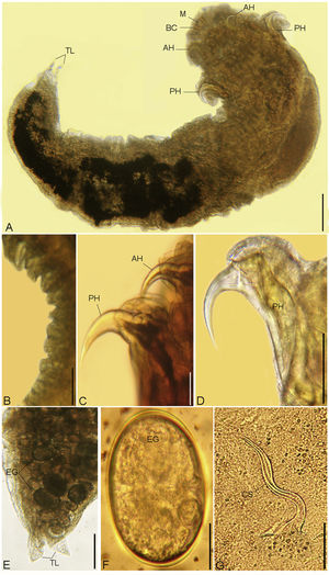 (A - G). Photomicrographs of R. aegypti showing: A Whole mount preparation of adult female with a broad cephalothorax that consists of a terminal mouth (M) at the apex supported by buccal cadre (BC), a pair of anterior hooks (AH), and a pair of sharp tipped posterior hooks (PH), abdomen terminated in divergent terminal lobes (TL), bar 50μm. B Abdominal annuli, bar 100μm. C, D Anterior (AH) and posterior (PH) hooks, bars 100μm. E Posterior part of a female abdomen with terminal lobes (TL), note the presence of eggs (EG), bar 50μm. F Eggs (EG), bar 10μm. G Copulatory spicule of male (CS), bar 10μm.