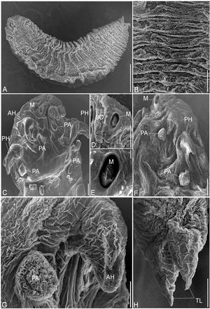 (A - H). Scanning electron micrographs of R. aegypti showing: A The adult parasite with an anterior cephalothorax and abdomen terminated in divergent terminal lobes, bar 500μm. B Abdominal annuli, bar 100μm. C Cephalothorax consists of a terminal mouth (M), two pairs of hooks, anterior (AH) and sharp posterior (PH), each with prominent cephalic papillae beside (PA), bar 100μm. D, E The terminal mouth surrounded by a buccal cadre (BC), bars 100μm; 10μm. F Lateral view, posterior hook (PS) and papillae (PA), bar 100μm. G Anterior hook (AH) and its papillae (PA), bar 50μm. H Abdomen terminated in divergent lobes surrounding anal opening, bar 100μm.