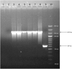 Electrophoresis on agarose gel of PCR products showing representative strains of Group 2. Lane 1: Negative control of PCR. Lane 2: Negative control of DNA extraction. Lane 3–7: profile of five strains evaluated. Lane 8: positive control of Group 2 (1674bp). Line 9: positive control of Group 1 (607bp). Line 10: molecular marker Dangsheng Biotech 100bp DNA ladder plus.