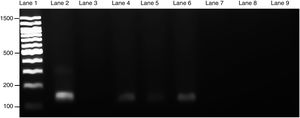 Presence of L. (L.) amazonensis in maternal spleen was confirmed by PCR. Three PCR products from each pregnant female group were used to make an electrophoresis gel. Lanes: 1: 100-bp molecular weight; 2: in vitro culture of L. (L.) amazonensis; 3: non-template control; 4–6: infected maternal spleen; 7–9: non-infected maternal spleen. The size of the product was 120-bp.