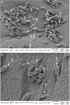 Scanning electron microscopy of parasporal crystals from Bacillus thuringiensis strains Bt-UNVM_84 and Bt-UNVM_94 (C=crystal, S=spore). (A) B. thuringiensis strain Bt-UNVM_84 showed combinations of amorphous to spherical parasporal crystals of ∼0.7–0.9μm from two points along the diametral axis. (B) B. thuringiensis strain Bt-UNVM_94 exhibited quasi symmetric bipyramidal parasporal crystals of ∼1.0–1.2μm from two points along the longitudinal axis. Crystal size was measured using ImageJ.4 Parameters used for image acquisition are shown: Mag=magnification (K×=1000×), WD=work distance, Eht=energy high tension, Det=detector type and SE2=secondary electron.