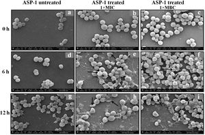 SEM images of ASP-1 (1× MIC and 1× MBC) treated and untreated S. aureus ATCC29213 cells. Normal morphology of ASP-1 untreated S. aureus ATCC29213 cells (45000×) at different time points (a, d, and g); ASP-1 treated bacterial cells at 0h showing smooth cell surfaces with no discernible ultrastructural changes (b and c); ASP-1 treated cells showing deformities and central perforations within 6h of exposure (e and f); the SEM image reveals extensive cell surface damage at 12h as indicated by spurting of cellular contents and loss of shape (bending) with the central hollowing (h); several biconcave cells with central depression and cavity showing concomitant leakage of cytoplasmic contents at 1× MBC (16μg/ml); the field also shows some distorted cells lying at the periphery (i), and cells with dents, surface blebs and plicated surfaces have been observed. Several cells appeared as punctured with spewed-off cytoplasmic contents. Black solid arrows have indicated major structural changes.