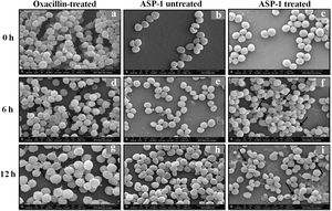SEM images of oxacillin-treated, ASP-1 (1× MIC and 1× MBC) treated and untreated MRSA-4 cells. The SEM images of oxacillin (1× MIC=32μg/ml)-treated MRSA-4 cells captured at 0, 6 and 12h (a, d, and g); though few cells appear healthy as revealed by septum formation, other cells turned biconcave and deformed, and a single cell lying near the center showing a circular depression at 12h (d and g); SEM images of untreated MRSA-4 cells showing normal morphology and several healthy cells at dividing stage (b, e, and h); micrographs of ASP-1 treated cells (c, f, and i); cells showing normal morphology at 0h (c); biconcave and elliptical cells exhibiting central collapses, deep craters and deformations (f–i); and ASP-1 (1× MBC=16μg/ml) treated bacterial cells at 12h, showing centrally collapsed biconcave cells with spewed-off contents after cell lysis (i). Black solid arrows have indicated major structural changes.