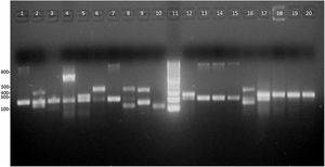 Productos de amplificación de factores de virulencia de Escherichia coli provenientes de aislamientos de pacientes y de cepas control. Calles 1, 13 y 14: E. coli 2348/69 (eae), calles 2, 9 y 16: E. coli KNH-172 (lt y stp), calles 3, 18 y 19: ausencia de factores de virulencia (pacientes), calle 4: E. coli C-481 (ipaH), calles 5 y 12: aislamientos de pacientes (aggR), calle 6: aislamiento de paciente (stx2), calles 7 y 15: aislamientos de pacientes (eae), línea 8: E. coli EDL933 (stx1 y stx2), calle 10: E. coli O126-53 (sth), calle 17: E. coli 17-2 (aggR), calle 20: E. coli ATCC 25922 (16S rRNA). Calle 11: marcador de PM (100 pb).