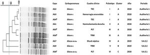Características clínicas y estructura poblacional de A. baumannii resistentes a carbapenems recuperados de pacientes internados en UCI1 durante el desarrollo del protocolo de vigilancia. PLT: politraumatismo; TEC: traumatismo encéfalo-craneal; TRM: traumatismo raquimedular; V.A.E.1: vigilancia activa etapa 1; V.A.E. 2: vigilancia activa etapa 2. A: coexistencia con P. aeruginosa VIM-2. B: coexistencia con K. pneumoniae KPC-2 C: coexistencia con K. pneumoniae OXA-48-like y E. coli OXA-48-like.