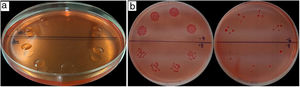 Congo red (RC) Petri plates with 20μl drop volume of 10−4, 10−5, 10−6, 10−7 dilutions, in quadruplicate. a. Drops distribution on the RC medium surface. b. Typical colonies of Azospirillum spp. in numbers in accordance with the ten-fold dilutions. Photo credits: Dr. Mariana Puente (a) and Dr. Luciana Di Salvo (b).