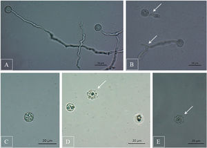 Efecto del extracto crudo producido por B. amyloliquefaciens KX953161.1 en la germinación de zoosporas de P. capsici. (A y B) Se advierte la germinación de zoosporas con tubo germinal largo, sin ramificar, en ausencia de extracto. (C y D) Se observa la inhibición germinativa de zoosporas en presencia del extracto crudo. Las imágenes fueron tomadas bajo microscopio, con objetivo de 10× en campo claro.