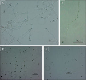 Efectos del extracto crudo producido por B. amyloliquefaciens KX953161.1 sobre la morfología y la germinación de zoosporas de P. capsici. (A) Zoosporas germinadas en ausencia del extracto. (B) Tubo germinativo anormal. (C) Zoosporas sin geminación (enquistadas). (D y E) Las paredes de la zoospora de P. capsici se lisaron al momento del contacto con el extracto crudo que contenía los lipopéptidos producidos por B. amyloliquefaciens KX953161.1. Las imágenes fueron tomadas bajo microscopio, con objetivo de 40× en campo claro.