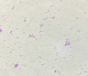 Campylobacter rectus: coloración de Gram.