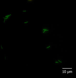 Microscopic field showing isolates VI detected with the FITC-labeled probe Pap446.