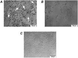Cytopathic effect (CPE) of culture supernatants on Vero cells. (A) GCD4 supernatant induces cell rounding with remaining long protrusions (white arrows) called difficile-type damage or D-damage; (B) GCD10 supernatant induces complete cell rounding form called sordellii-type damage or S-damage; (C) control cells.
