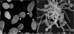 Candida albicans cells analyzed by scanning electron microscopy. In (A), yeasts are in the process of budding, the arrows indicate the site of cell division between the mother cell and the daughter cell. In (B), mycelia of C. albicans, involved in tissue invasion during the infectious process.