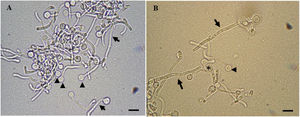 C. albicans cells in cell transition analyzed by light microscopy. In (A), a combination of chlamydospores (arrowheads) and hyphae (arrows) are found. In (B), pseudohyphae (asterisk), chlamydospores (arrowhead), and multicellular hyphae (arrows) are seen. Scale bars represent 5μm.