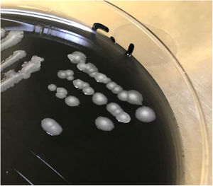 Colonias de Legionella pneumophila en agar BCYE a los 4 días de incubación a 35±2°C en 2,5% de CO2.