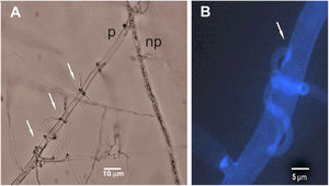 Light microscope observation of the interaction between hyphae of Trichoderma afroharzianum Th2RI99 (T) and Rhizoctonia solani AG4-HG II (R) in dual culture (WA 1.2%) after 47h. (A) Arrows: coilings of Th2RI99 on R. solani; p: plasmolized hyphae; np: not plasmolized hyphae. (B) Calcofluor dye. Arrow: detail of coiling of Th2RI99 on R. solani.