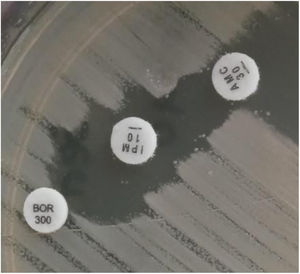 Phenotypic detection of SME-4. Double disc-synergy test: boronic acid (300μg)–imipenem (10μg) and imipenem (30μg)–amoxicillin clavulanic acid (30μg).