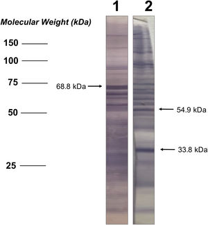 Immunoblot analysis to determine seroactive antigens (SAA). Results show a control individual (1) seropositive for SAA of 68.8kDa (arrow on the left) as well as a patient (2) with seropositivity for SAA of 54.9 and 33.8kDa (arrows on the right).