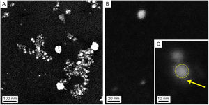 SEM images of colloidal AgNPs synthesized by strain 2 in secondary electron mode (accelerating voltage 3kV). (A) Panoramic view of AgNPs, showing isolated NPs as well as some agglomerates produced in the drying process of the sample. (B) Isolated NP. (C) Detail of an AgNP (dotted circle) and capping (arrow).