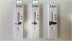 LFA testing results of the Stenotrophomonas maltophilia isolate (H) showing a slight band for OXA-48 and NDM. For comparison reasons, the result of a positive KPC-producing Klebsiella pneumoniae is also shown (D700).