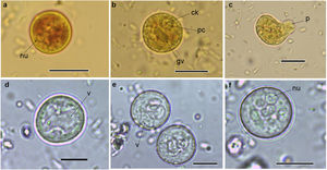 Cysts and trophozoites of Entamoeba found in populations from Argentina: (a and b) immature cysts of Entamoeba complex staining with Lugol; (c) trophozoite of Entamoeba complex staining with Lugol; (d and e) immature cysts of E. coli; (f) mature cyst of E. coli.Abbreviations: nu: nucleus; ck: central karyosome; gv: glycogen vacuole; pc: peripheral chromatin; v: vacuole; p: pseudopodia. Scale bars: a–f=10μm.