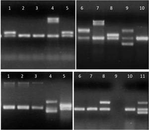 Detalle de los productos de amplificación en gel de agarosa de aislamientos de E.coli. Arriba, línea 1, 5 y 8: gen aggR; líneas 4 y 7: gen ipaH; línea 6: gen stx2; línea 9: genes stx1 y stx2; líneas 2, 3 y 10: sin factores de virulencia. Abajo, líneas 1 a 3: gen eae; líneas 4 y 11: genes lt y stp; línea 5: gen aggR; línea 8: gen lt; línea 9: sin muestra; líneas 6, 7 y 10: sin factores de virulencia.